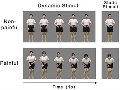 Empathy for pain in individuals with autistic traits during observation of static and dynamic stimuli